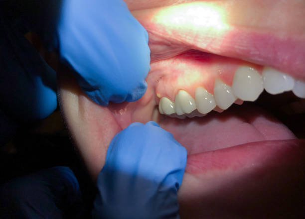 Best Emergency TMJ Treatment in White Center, WA