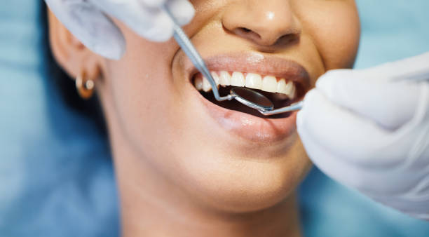 Best Urgent Care for Lost Fillings or Crowns in White Center, WA